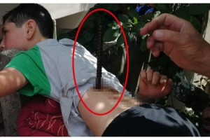 Ağaçtan düşen çocuğa inşaat demiri saplandı