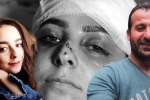 Eşi tayt giydi diye hastanelik etti, serbest kaldı!