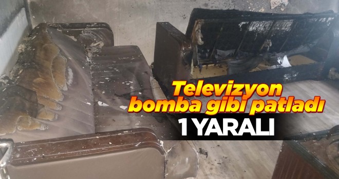 Televizyon Bomba Gibi Patladı